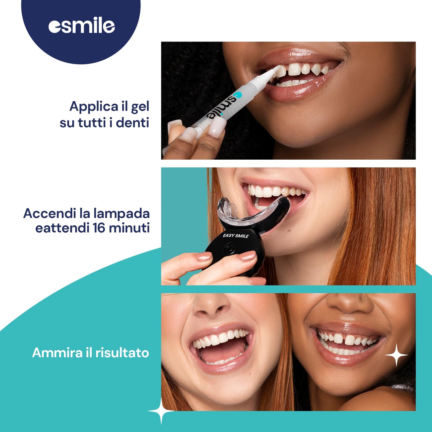 ESMILE - Kit Sbiancante Denti Professionale con Lampada LED - Elimina le Macchie in 16 Minuti - Sicuro per lo Smalto Dentale