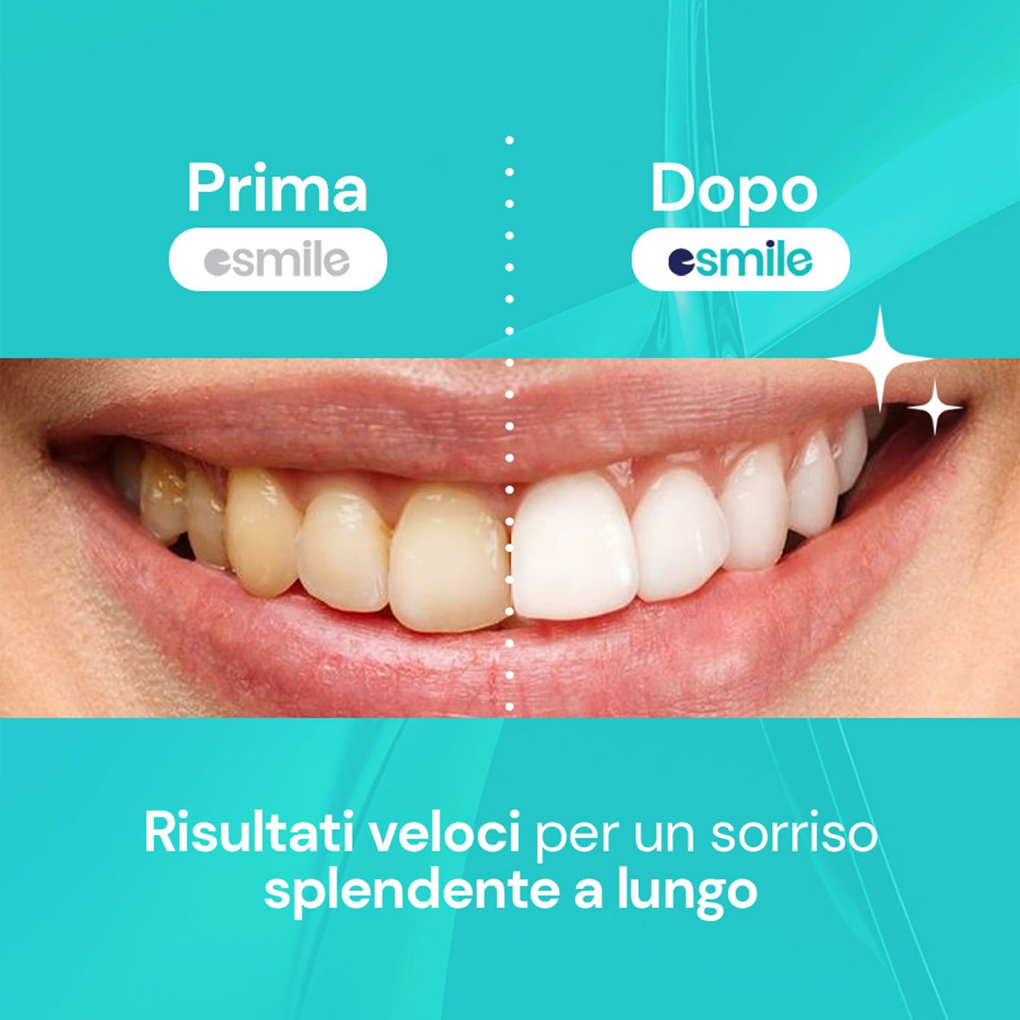 ESMILE - Kit Sbiancante Denti Professionale con Lampada LED - Elimina le Macchie in 16 Minuti - Sicuro per lo Smalto Dentale