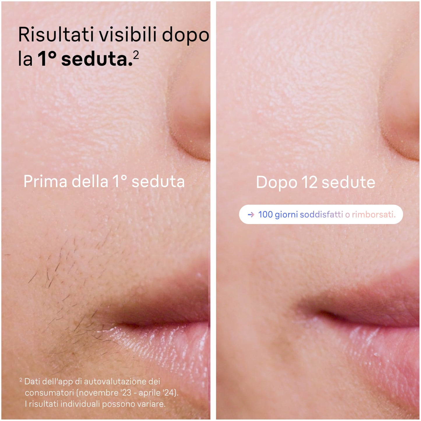 Braun Skin i·expert: recensione completa dell’epilatore a luce pulsata IPL smart
