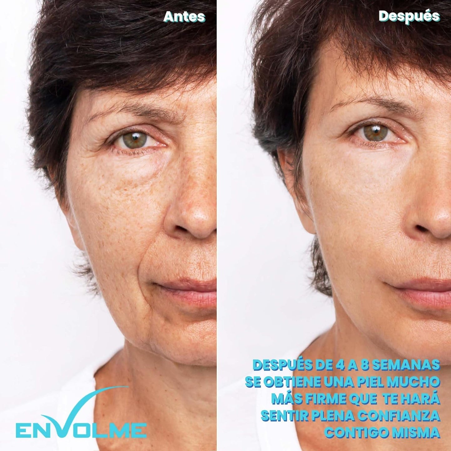 Skin Radiofrequenza Viso - Massaggiatore per Viso - Massaggiatore Viso Lifting - Collagene viso - Ultrasuoni Viso - Beauty Tool - Luce Rossa -